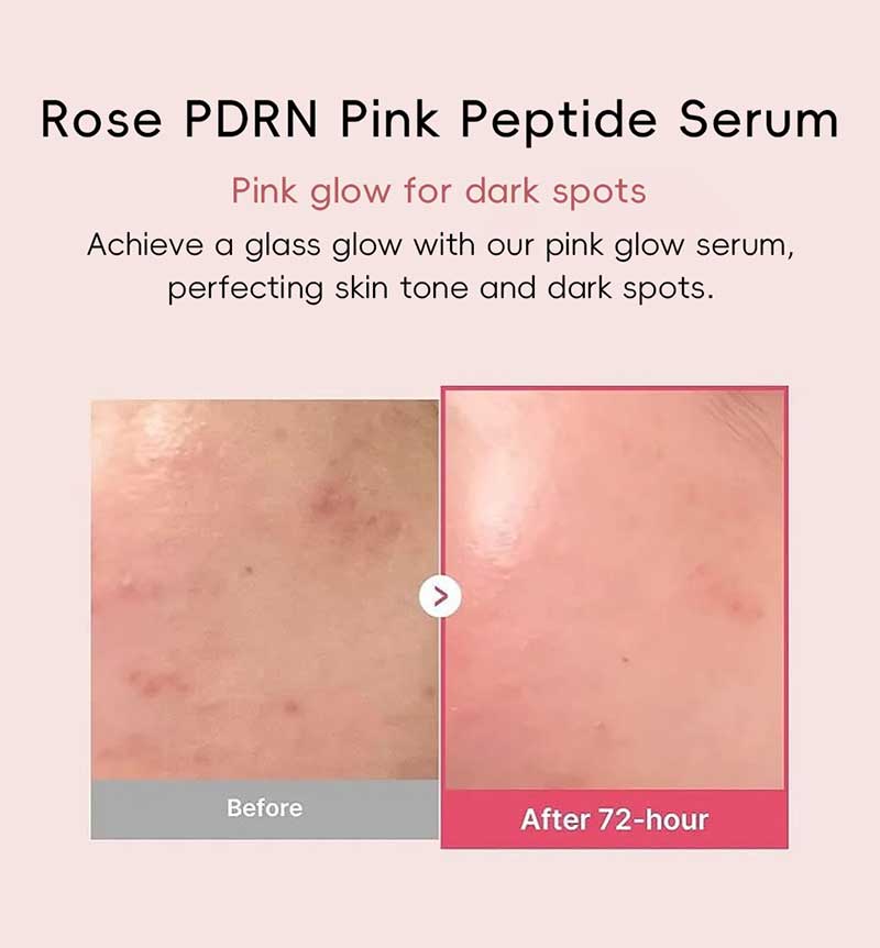 private label pdrn peptide serum